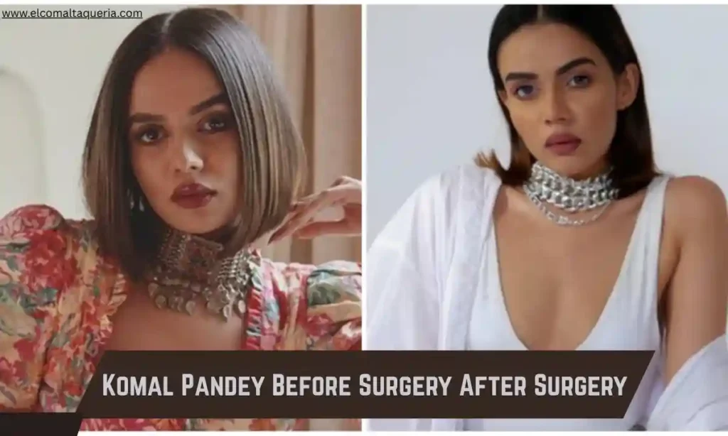 Komal Pandey Before Surgery After Surgery